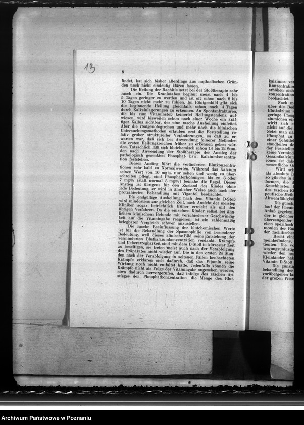 Obraz 17 z jednostki "Unterbringung der Gesundheitsämter. Ernährungsmängel. Schwesternstationen"