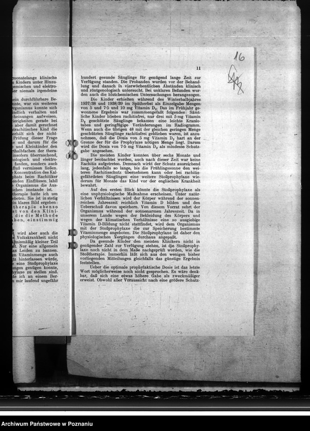 Obraz 20 z jednostki "Unterbringung der Gesundheitsämter. Ernährungsmängel. Schwesternstationen"