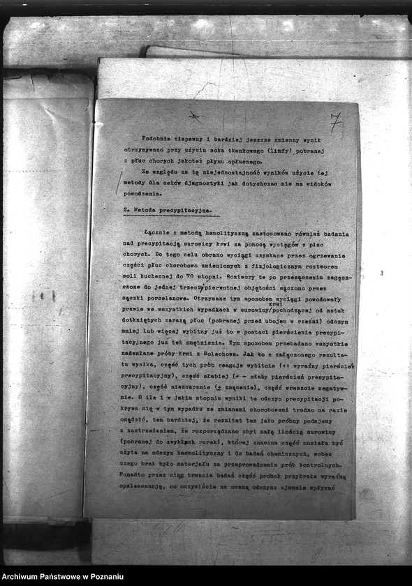 Obraz 11 z jednostki "Zaraza płucna - szczepienia ochronne"